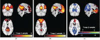 FIGURE 31.13. These fMRI activation plots are taken from Zhou et al.