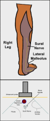 Figure, Ankle joint Image courtesy Dr Chaigasame] - StatPearls