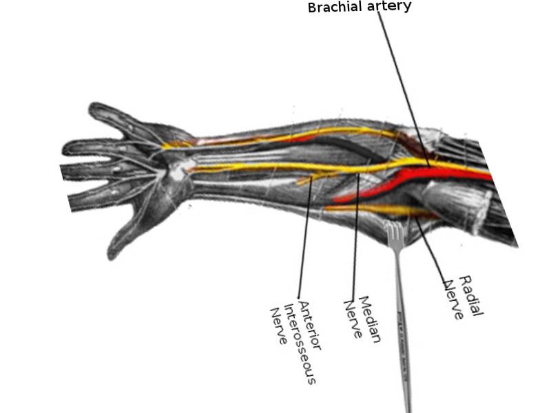 Anatomy Shoulder And Upper Limb Median Nerve Statpearls Ncbi