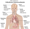 Main symptoms of infectious mononucleosis