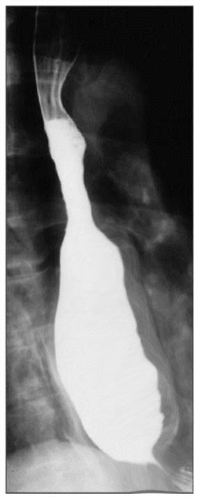 Figure, Median nerve Image courtesy S Bhimji MD] - StatPearls - NCBI  Bookshelf