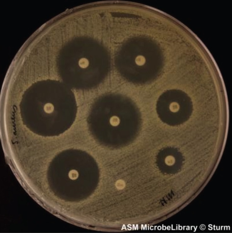 Figure 8. Kirby-Bauer disk diffusion susceptibility test on  coagulase-negative Staphylococcus aureus grown on Mueller-Hinton agar with  tetracycline (30 μg), cephalothin (30 μg), erythromycin (15 μg),  chloramphenicol (30 μg), vancomycin (30 μg ...
