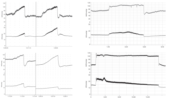 Figure 6.28. Protection of the eye from arterial pressure-dependent changes in IOP is a possible function of choroidal myogenic local control.