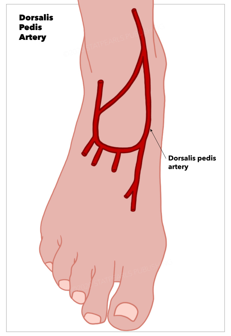 Figure, Dorsalis Pedis Artery. StatPearls Publishing ...