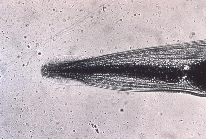 enterobius vermicularis ncbi)