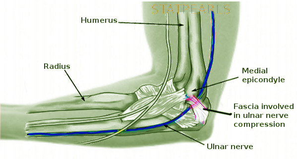 Figure, Cubital tunnel syndrome Image courtesy S Bhimji MD