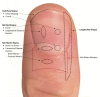 Location and orientation of nail biopsies