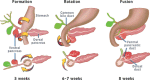 FIGURE 5. Pancreatic embryology.