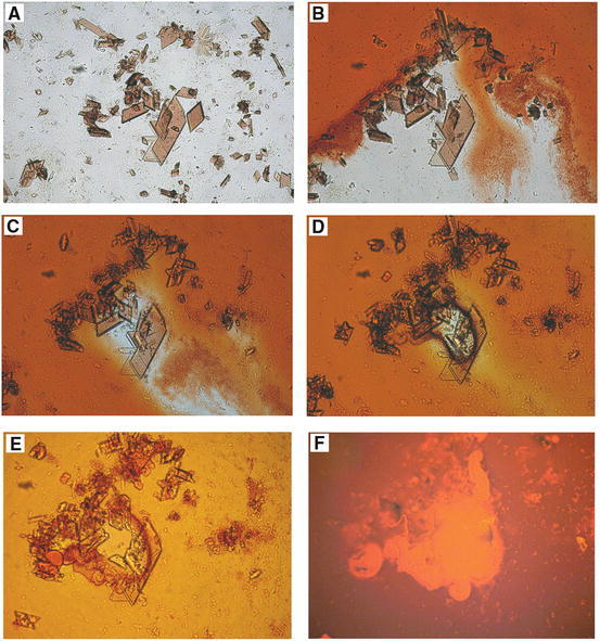 Fig. 3.5, [Disintegration of hemoglobin crystals (horse)...]. - Self ...