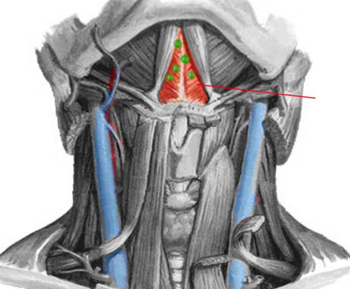 Anatomy Head And Neck Submental Triangle Statpearls Ncbi Bookshelf