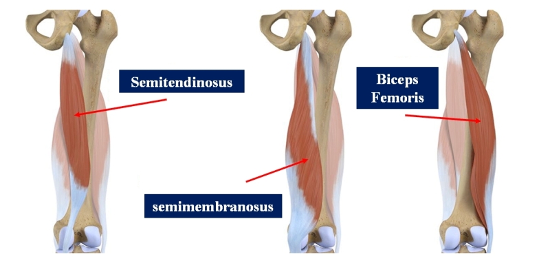 Anatomy, Bony Pelvis and Lower Limb, Hamstring Muscle - StatPearls