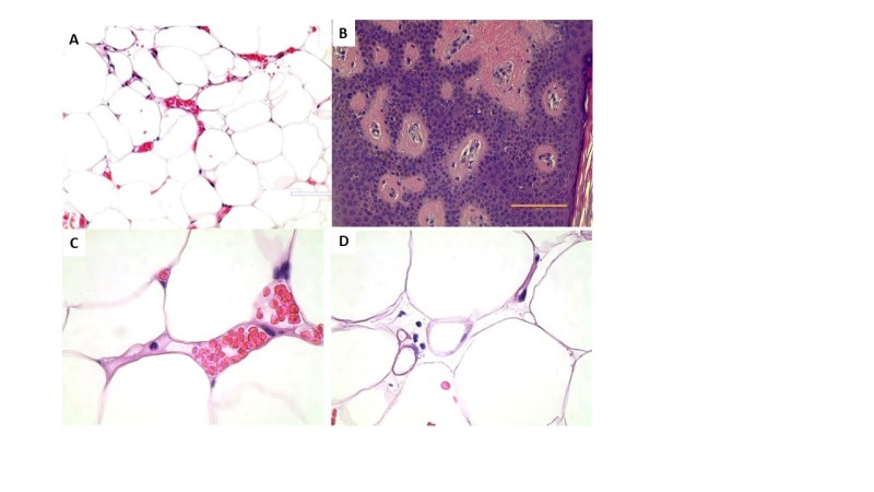 Figure 8. . Histological features of angiolipomas.
