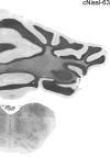 Coronal Plane: Section 63 - Nissl Staining.