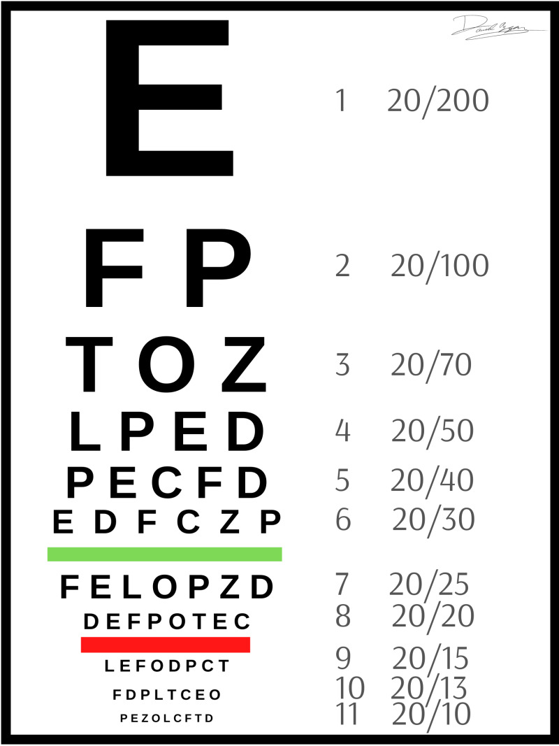 Figure, A Snellen eye chart for visual acuity testing. Contributed by  Daniel Azzam] - StatPearls - NCBI Bookshelf