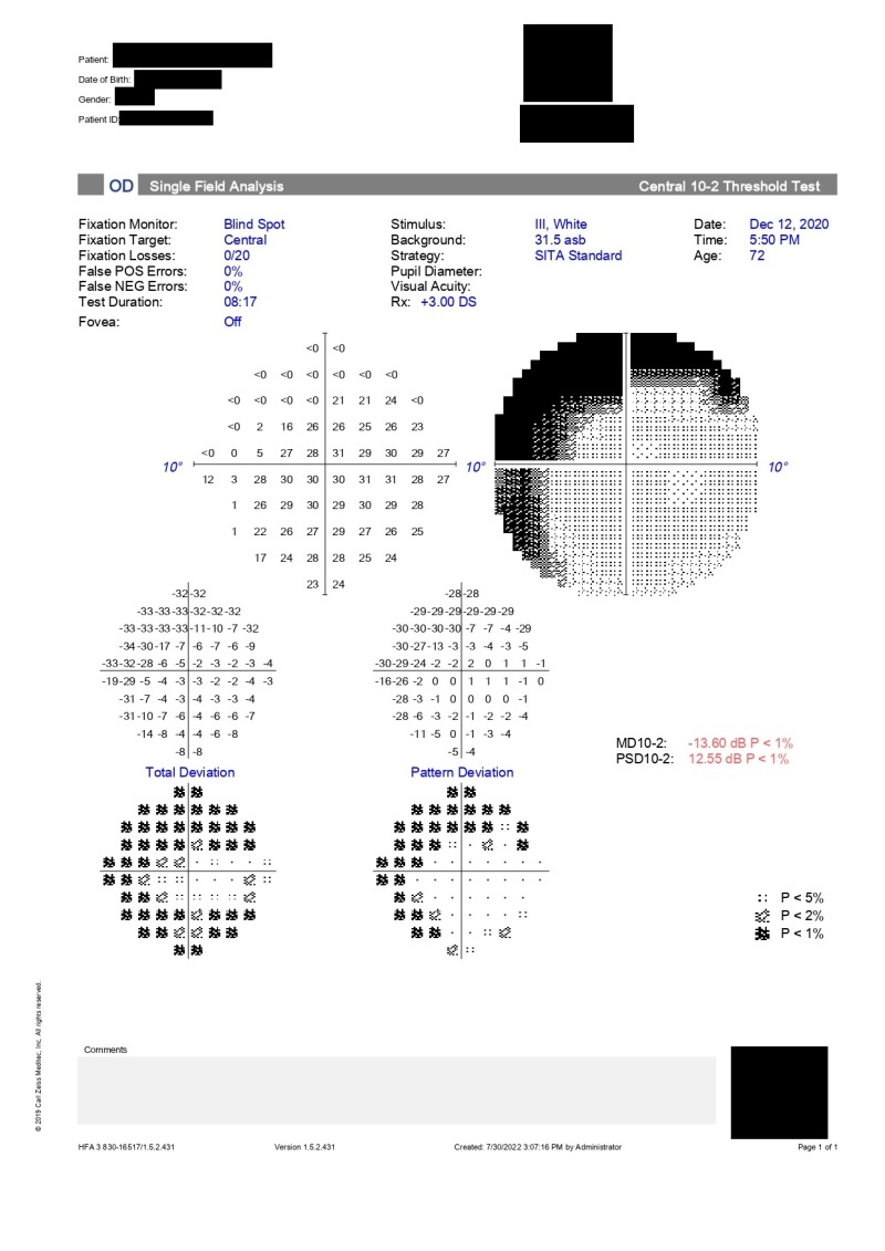 Figure Humphrey Visual Field Printout 10 2 Test Statpearls