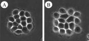 Figure 2. Phase contrast microscopy of NBT-II cells.