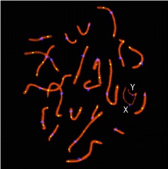 Figure 1. Example of human spermatocyte in pachytene stage.