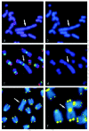 Figure 3. Telomere-mediated chromosome integrity in mammalian cells lacking telomerase or DNA repair factors.