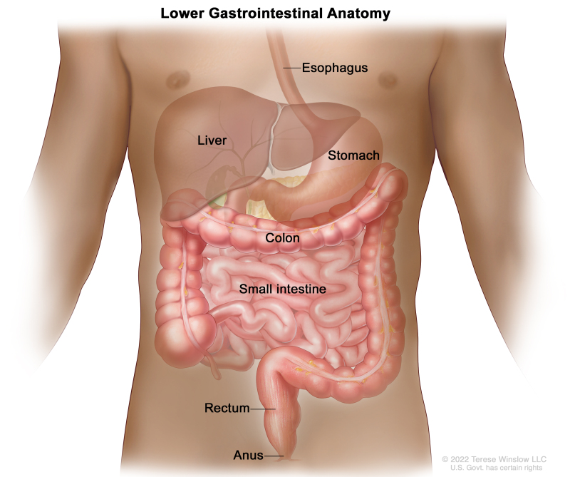 rectal cancer ncbi)