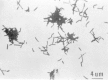 Figure 34-2. Gram stain of A israelii showing diphtheroidal rods and short branching filaments.