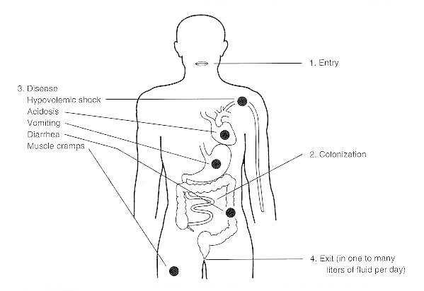 Figure 24-1. Pathophysiology of cholera.