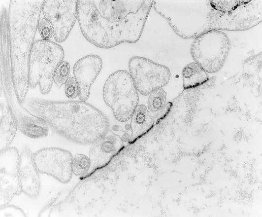 Figure 82-5. Transmission electron micrograph showing flagellates of T cruzi attached by hemidesmosomes to the epithelium of the rectal gland of Triatoma dimidiata.