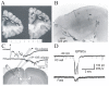 Figure 1. Undercut cortex in rats and humans.