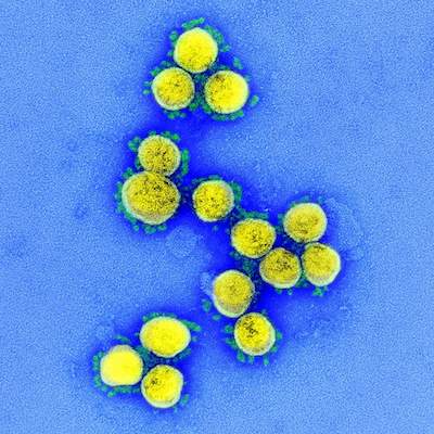 Transmission electron micrograph of SARS-CoV-2 virus particles, isolated from a patient. Image captured and color-enhanced at the NIAID Integrated Research Facility (IRF) in Fort Detrick, Maryland. NIAID