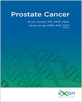 pathology of prostate cancer ncbi