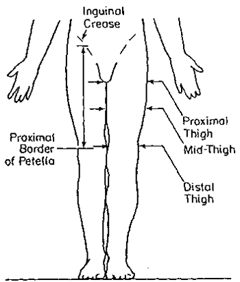Anterior view of locations for thigh circumferences.