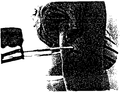 Measurement of skinfold thickness with caliper.