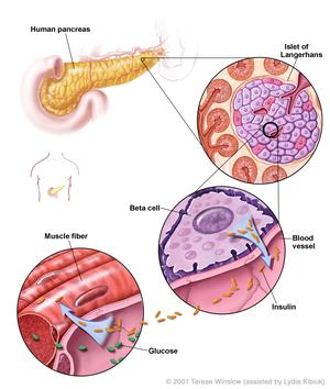 pancreas diabetes insulin insulina mellitus cellule diabete glucose langerhans celulas clulas abbott organ pankreas nlm secretion ncbi nih