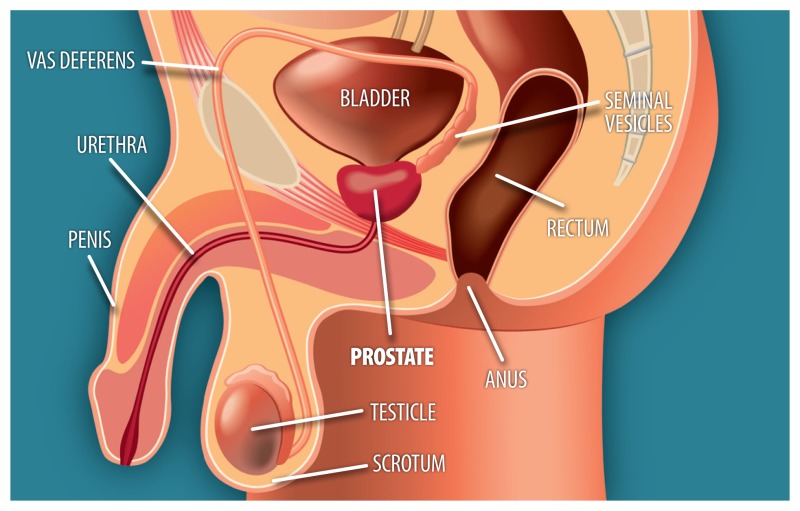 prostate cancer treatment ncbi hogy gyógyítják- e a prosztatitisből